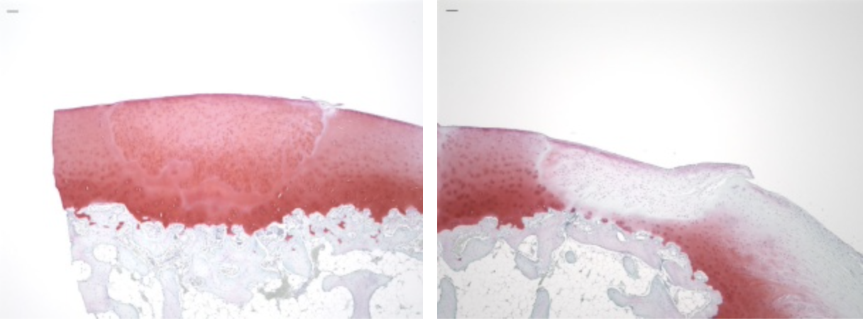 iPS-derived cartilage shown to repair cartilage defects in monkeys